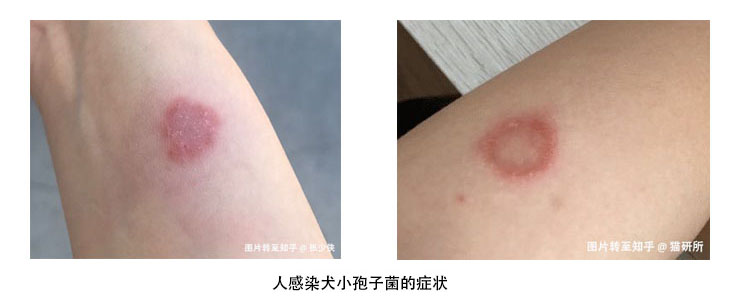 猫皮癣